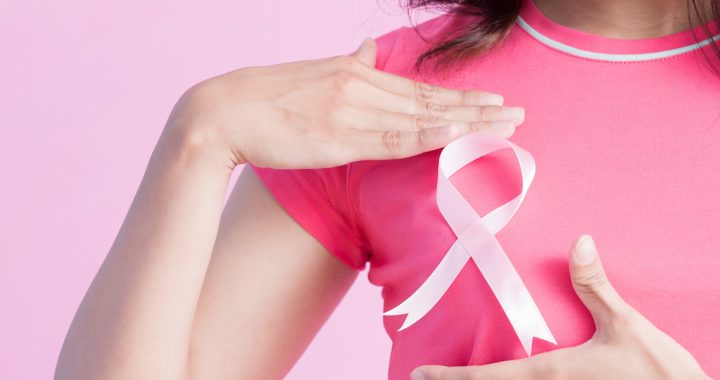 hidden scar breast cancer surgery - mercy health