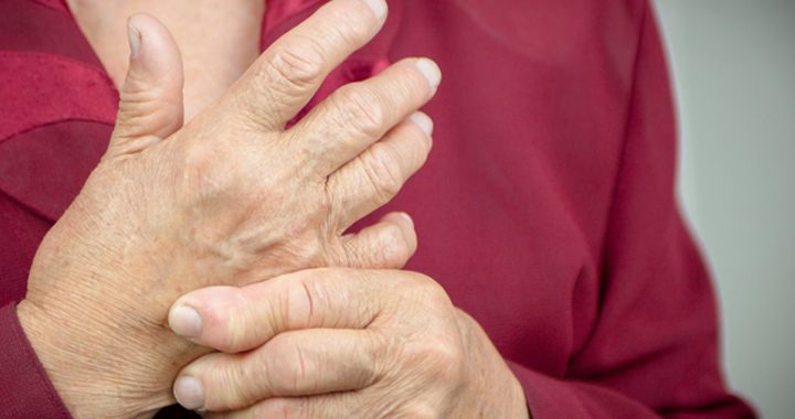 Rheumatoid Arthritis Signs Symptoms and Treatment | Mercy Health Blog