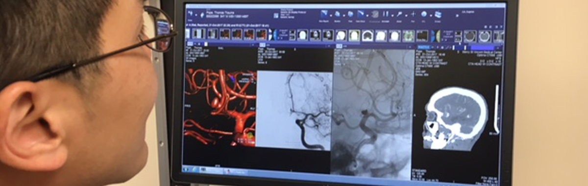 cerebral aneurysm recovery story