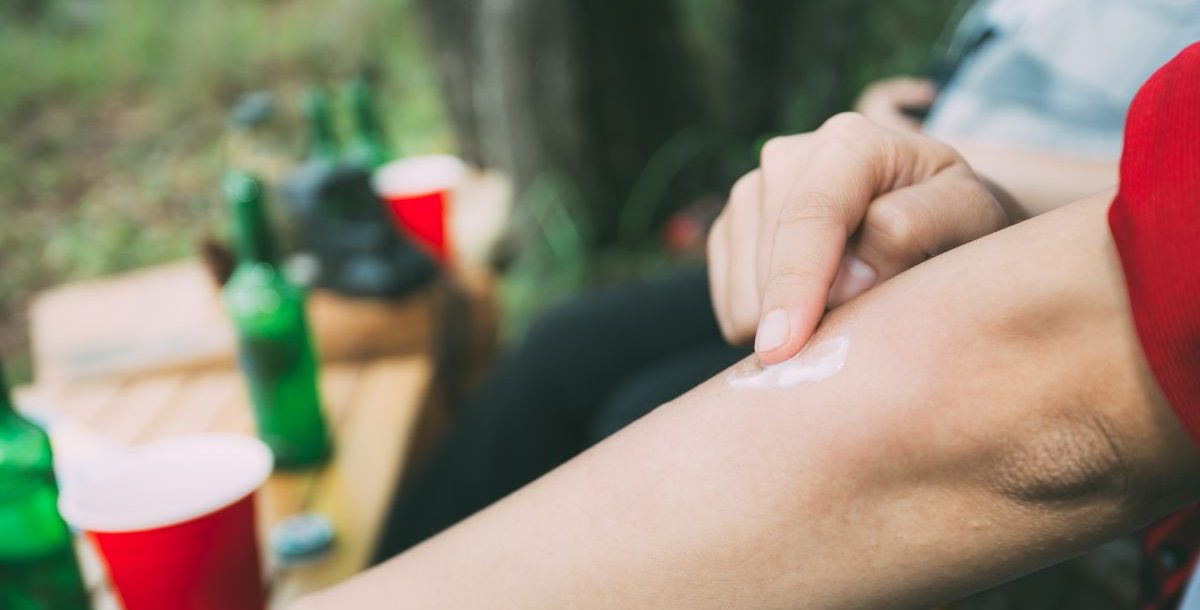 insect sting treatment