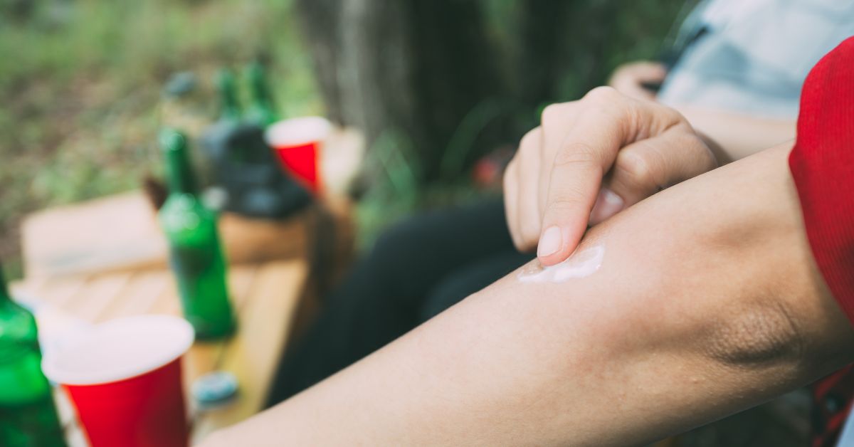 insect sting treatment